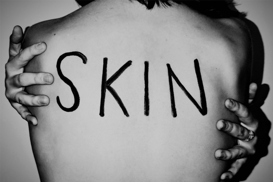 A person's back with SKIN written across it in black marker pen